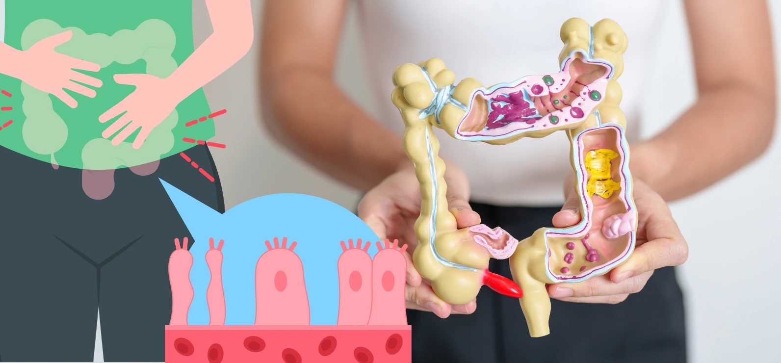 Qué es el SIBO y Cuáles son sus Síntomas -Especialista en Nutrición Integrativa Mayte Castellano Health