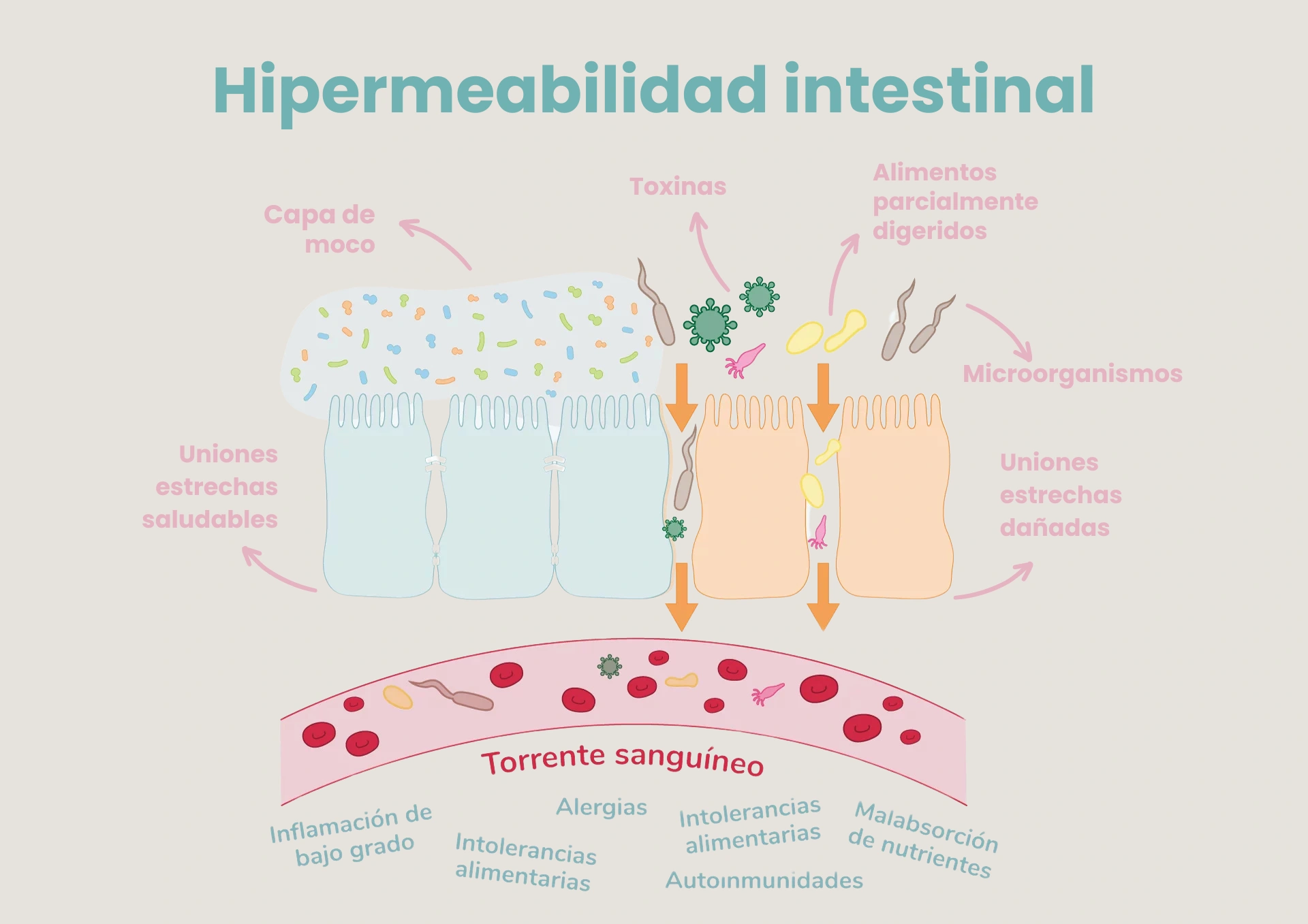 Hipermeabilidad intestinal - Nutrición Integrativa Mayte Castellano Health