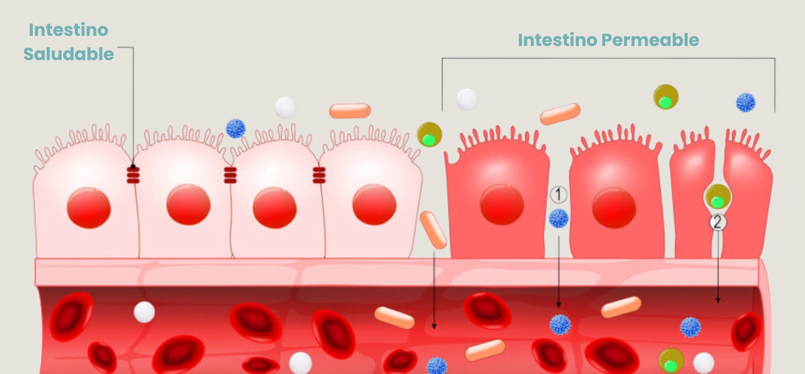¿Tengo Intestino Permeable?