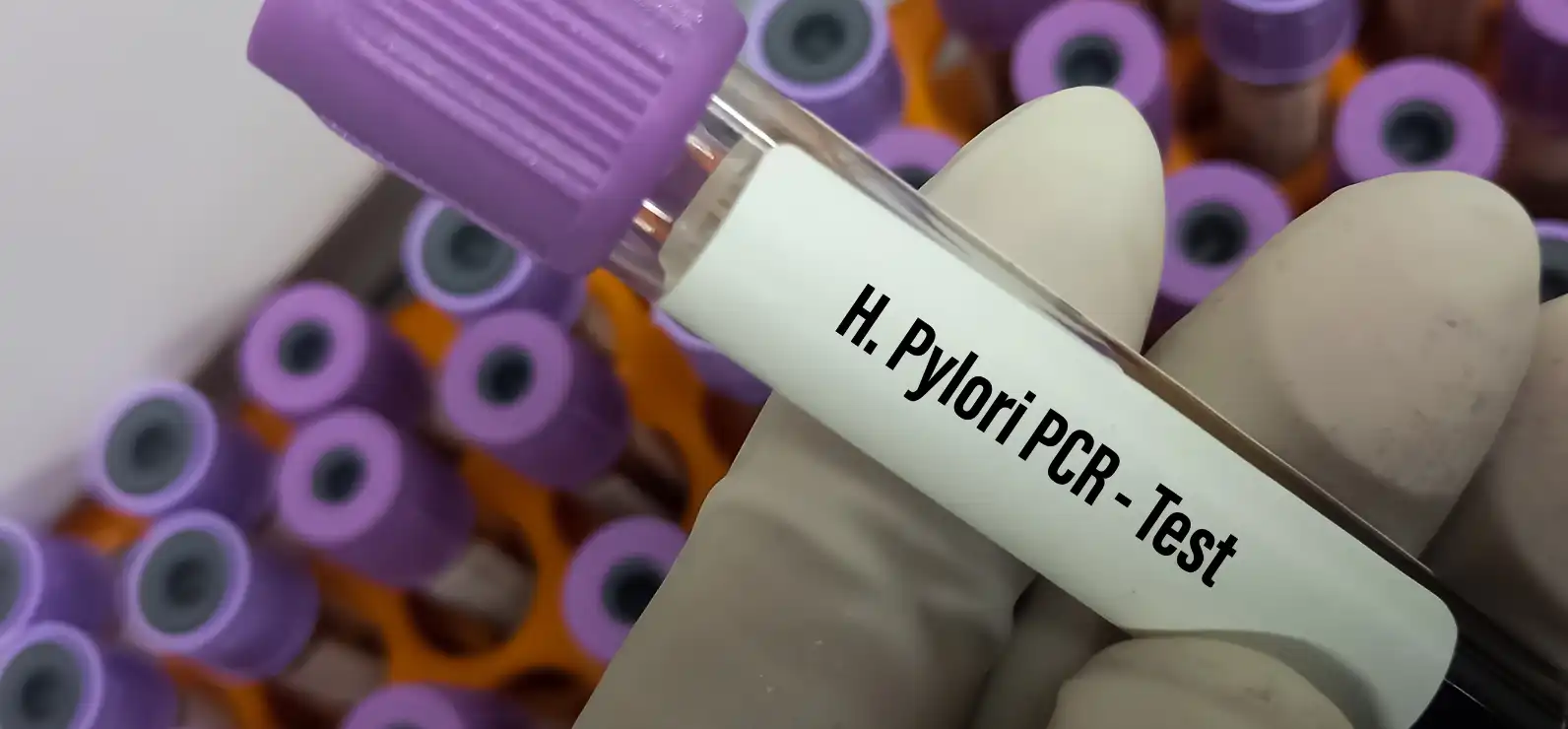 Síntomas de la bacteria H. Pylori
