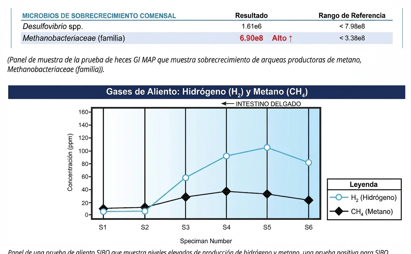 Prueba de aliento para detectar SIBO por nutrición integrativa Mayte Castellano